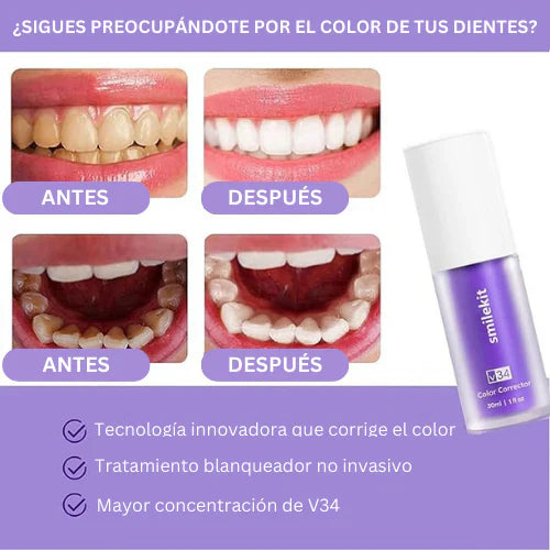 Blanqueador Dental V34™ - TRENDFINDER® (2024)